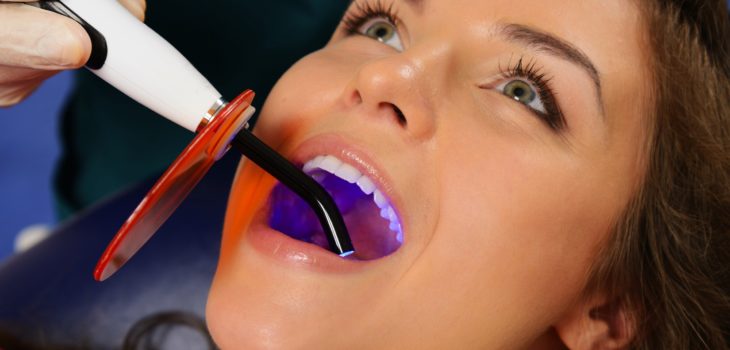 What is an LED curing light when it comes to dental work?